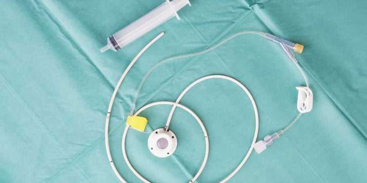 Totally Implantable Access Port Market Insight | Outlook | Growth Analysis Report 2032