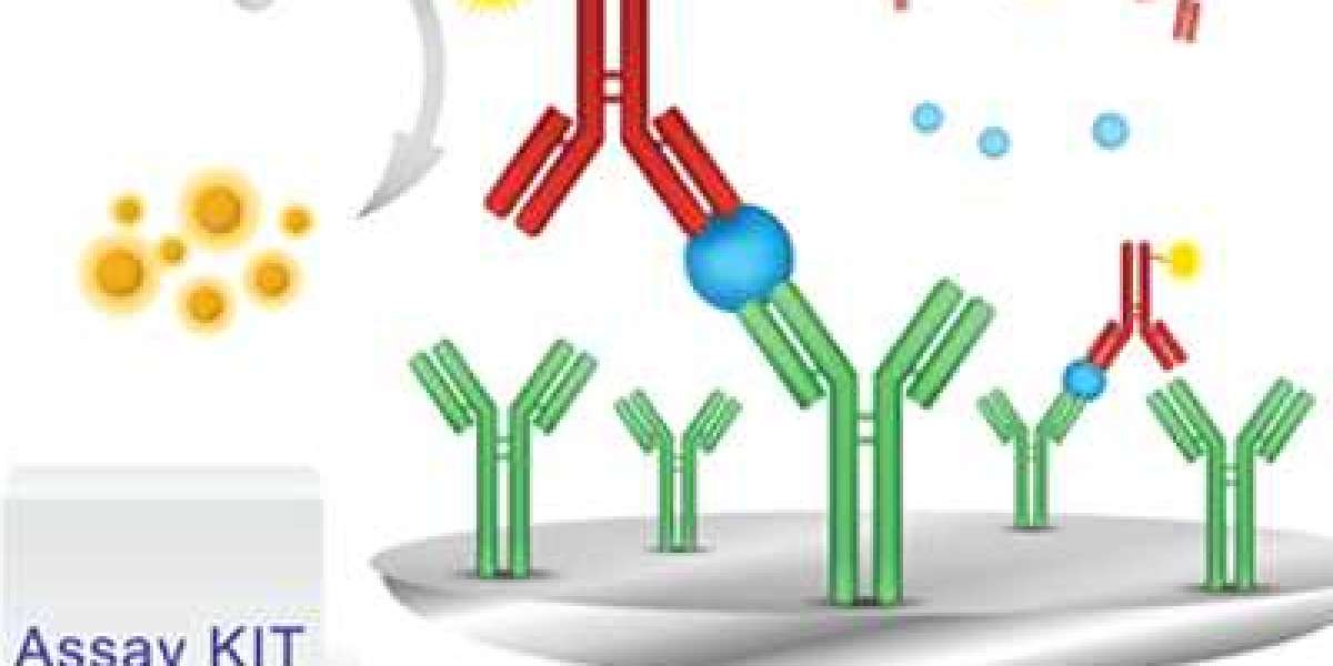 Amino Acid Assay Kits Market Key Players, Latest Trades & Forecast Report to 2032