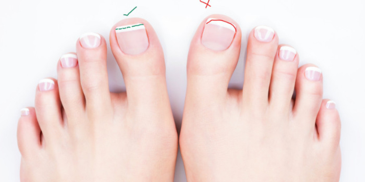 Foot Soul Podiatry – Toeflex Hybrid Gel for Healthy Toenails