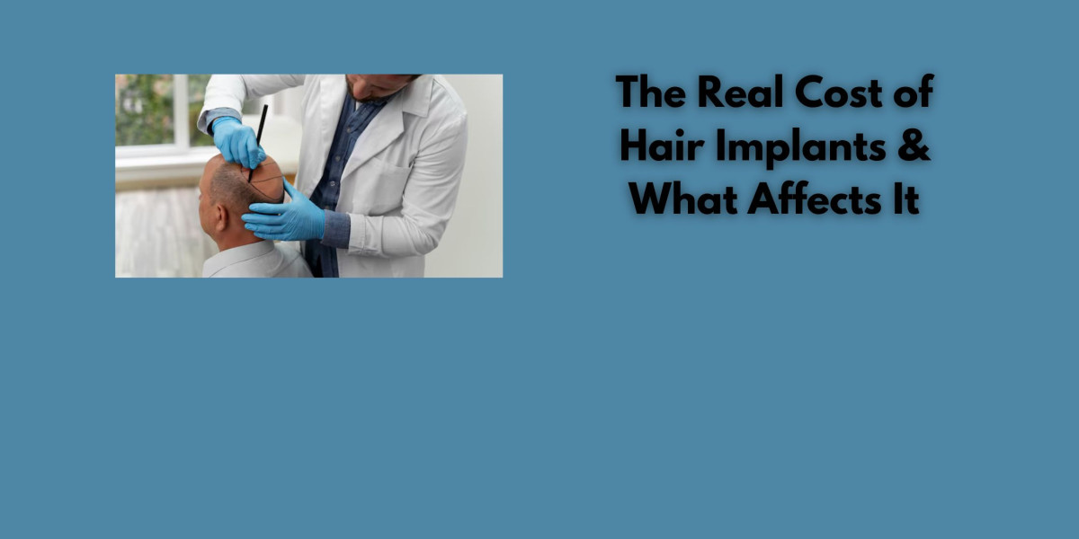 The Real Cost of Hair Implants & What Affects It