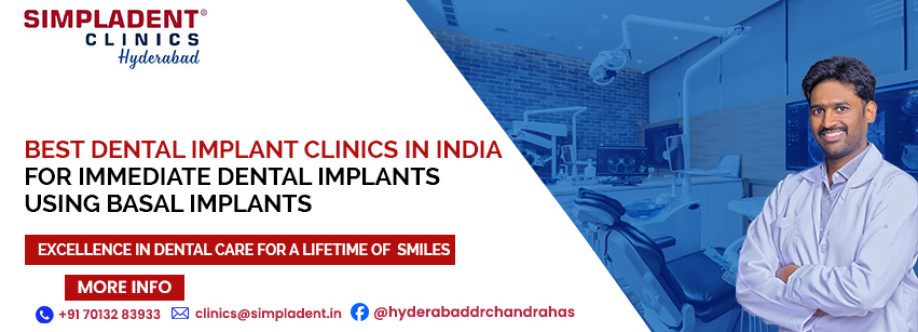 Best Doctors For Dental Implantation in Hyderabad Cover Image