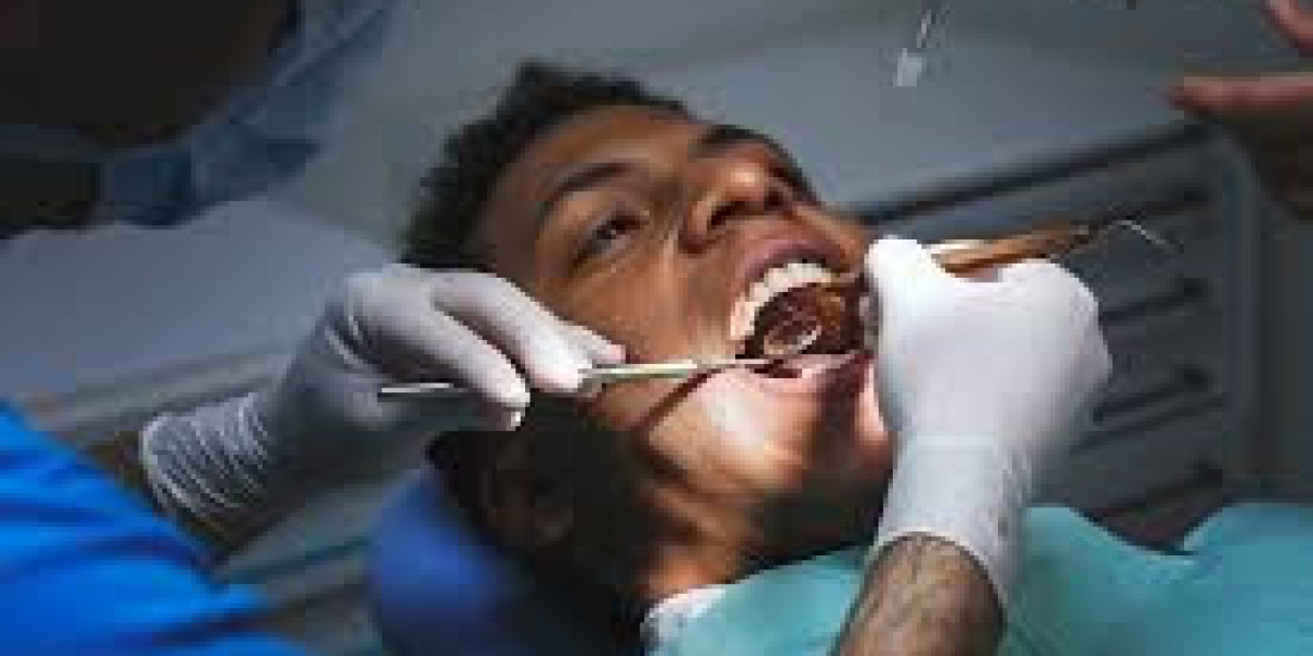Is Wisdom Teeth Removal Worth the Cost? A Complete Guide
