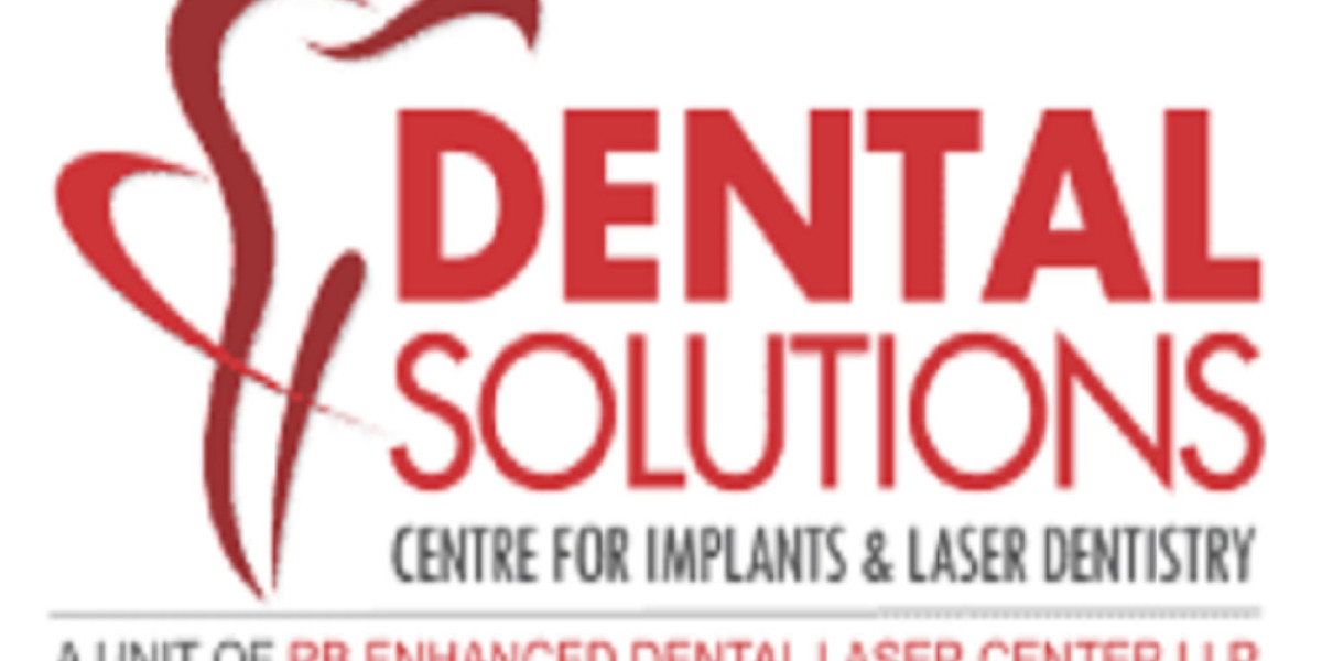 Dental Implants in Bangalore: Restore Your Smile with Expert Care