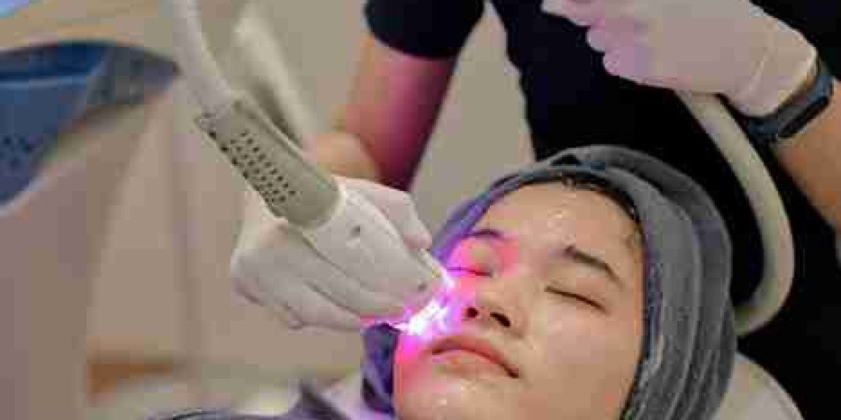 Laser Hair Removal: Smart Choice for Permanent Smoothness