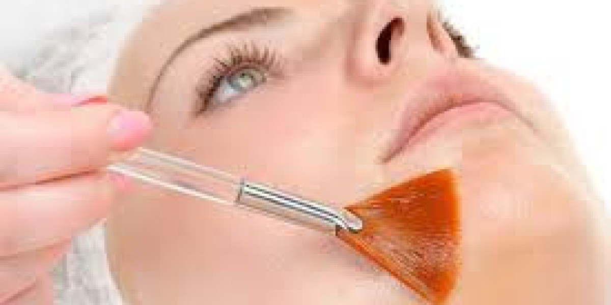 Carbon Laser Facial: The Secret to Radiant, Refreshed Skin